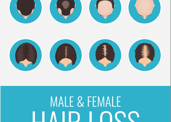A Better Way to Solve the Hair Loss Problem