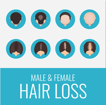 A Better Way to Solve the Hair Loss Problem