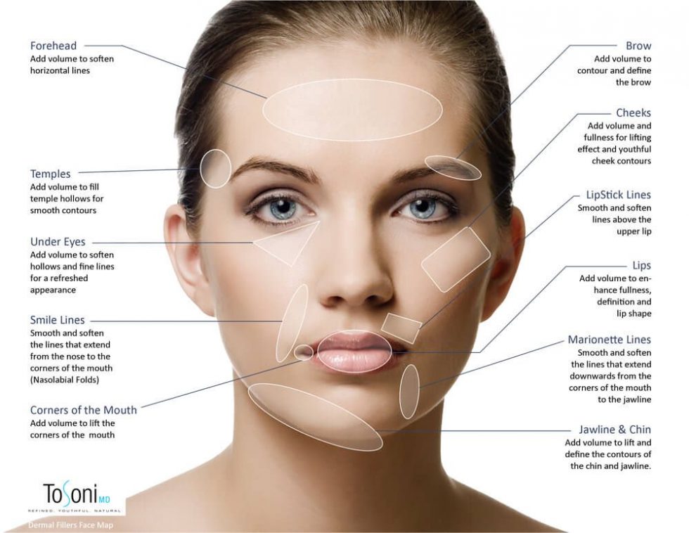 Fillers - Dr. Scott's Restorative Health & Aesthetics