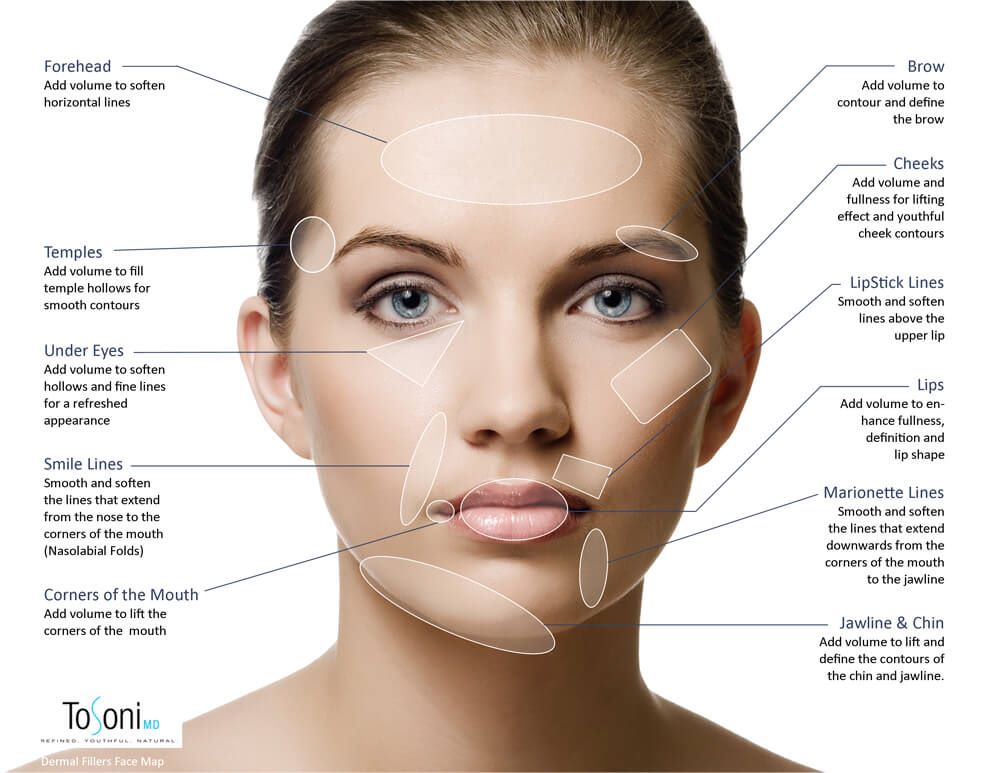 Fillers - Juvederm® Sculptra® - Dr. Scott's Restorative Health & Aesthetics